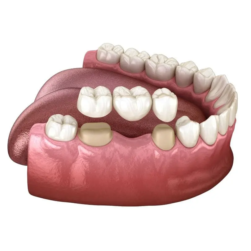 Zahnarzt-für-hochwertigen-Zahnersatz-in-Wilmersdorf